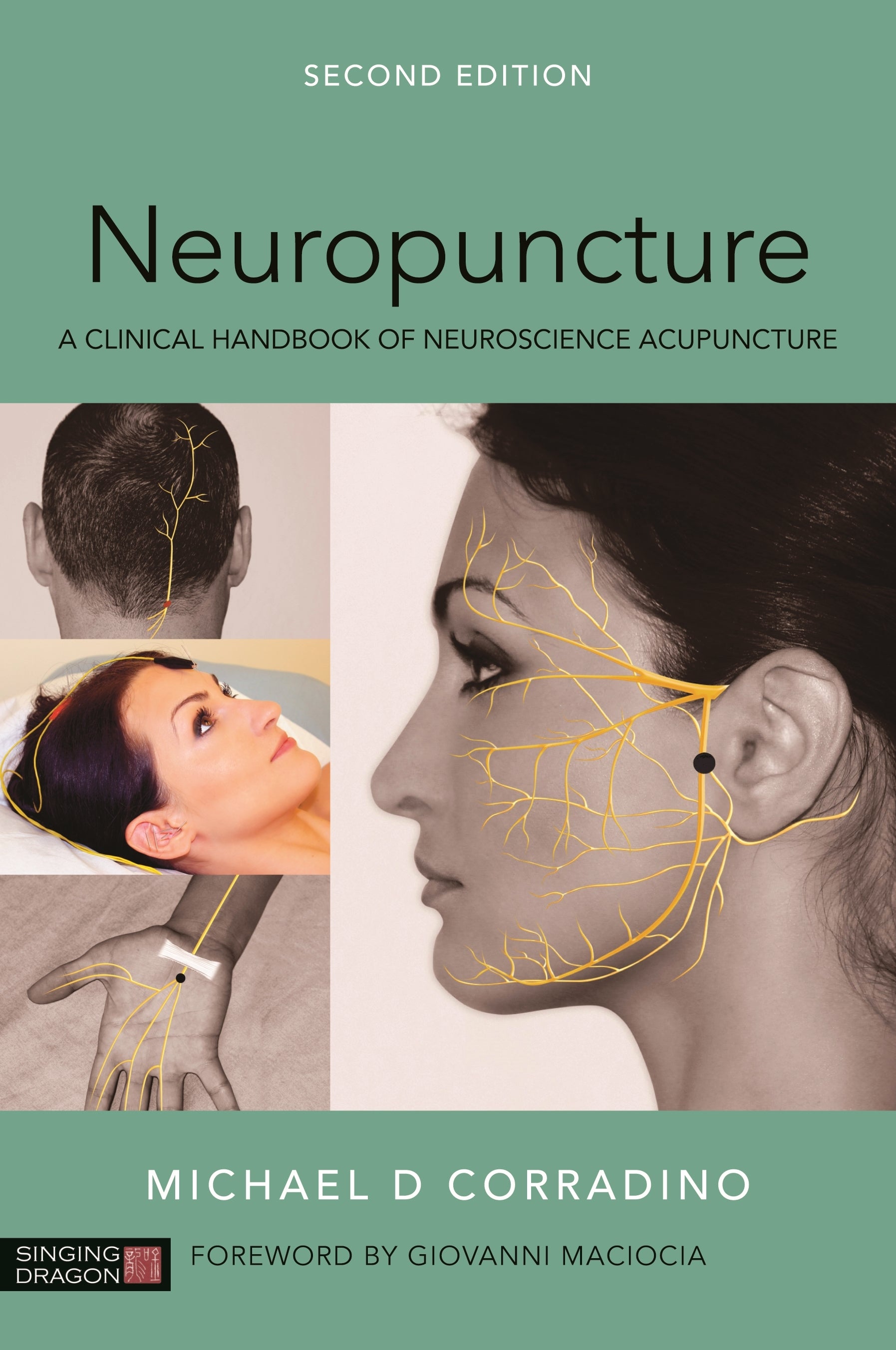 Neuropuncture by Giovanni Maciocia, Michael Corradino