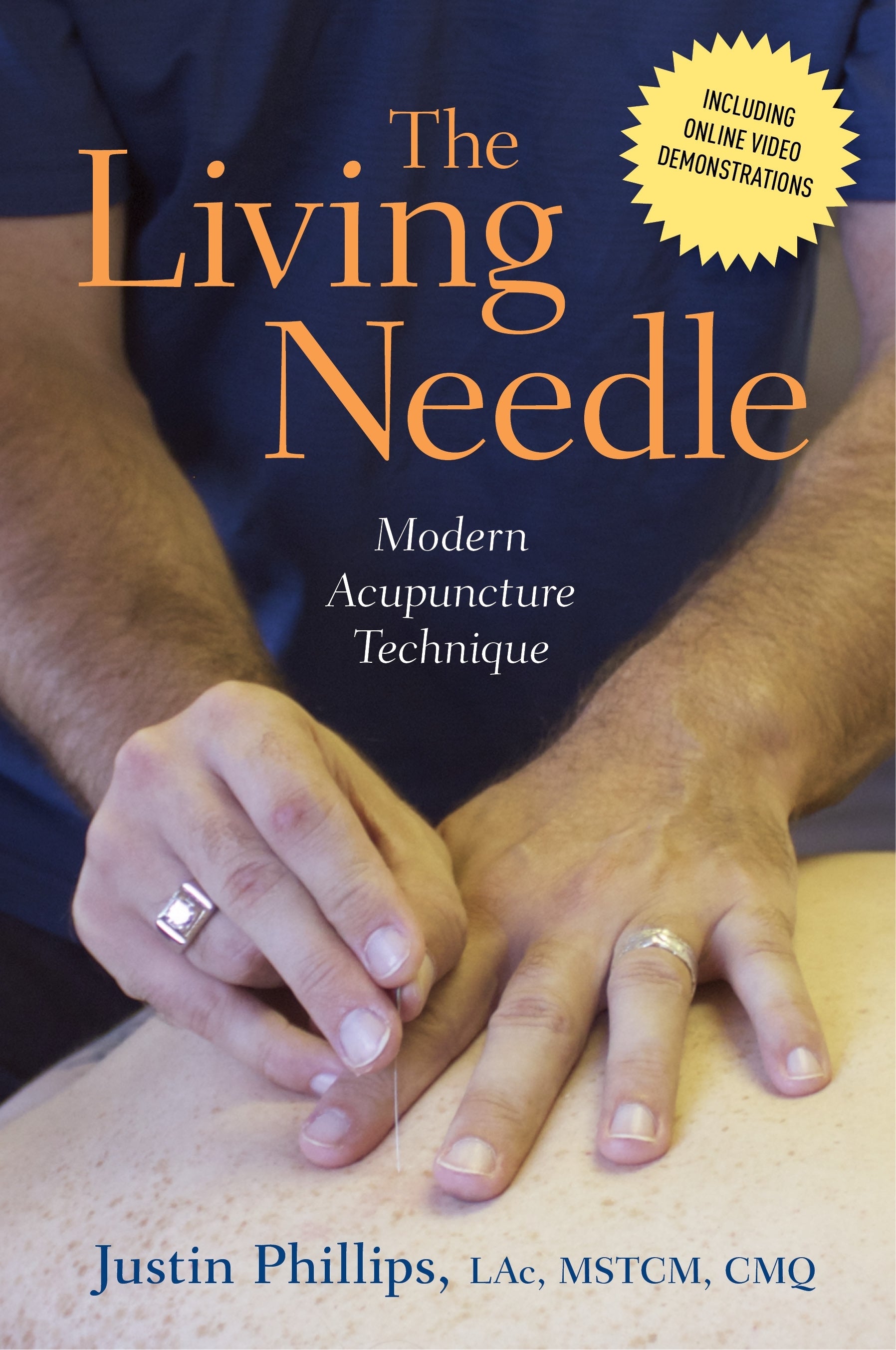 The Living Needle by Justin Phillips